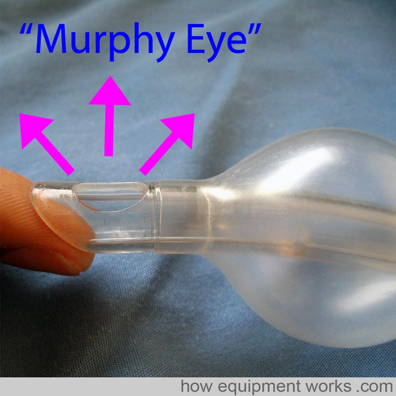 murphy_eye