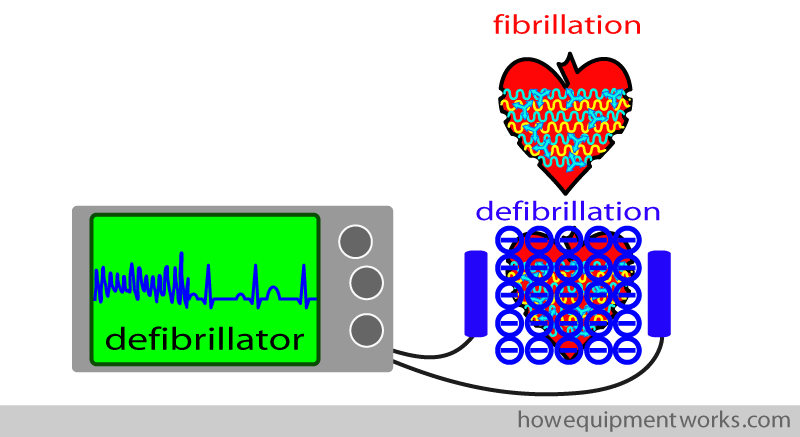 three_definitions