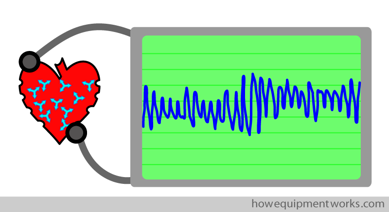 vf_monitor